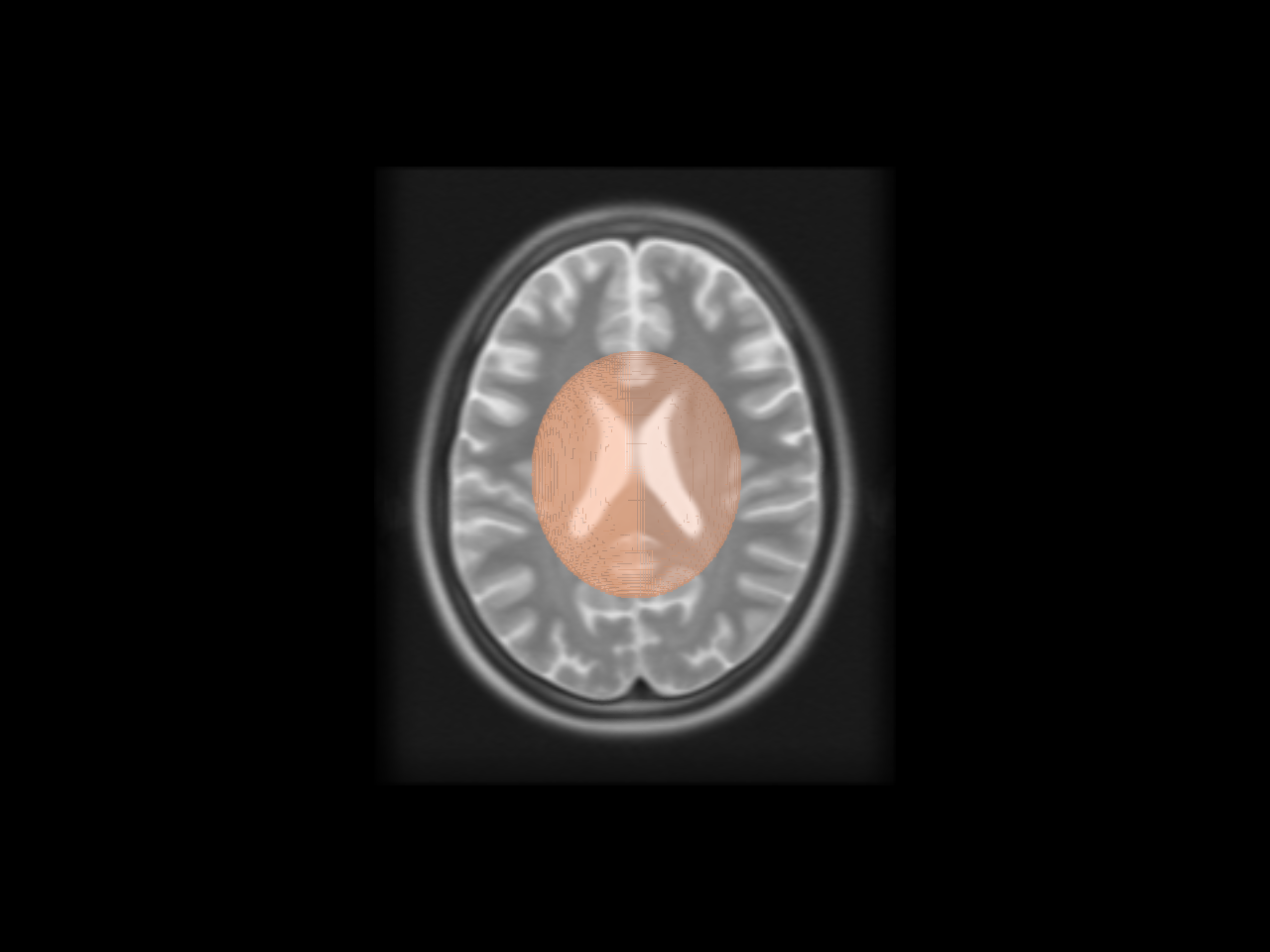 viz contour