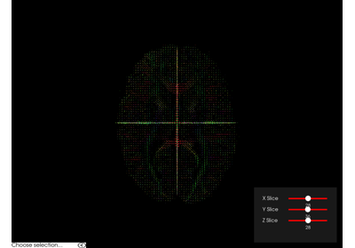 Brain Fiber ODF Visualisation
