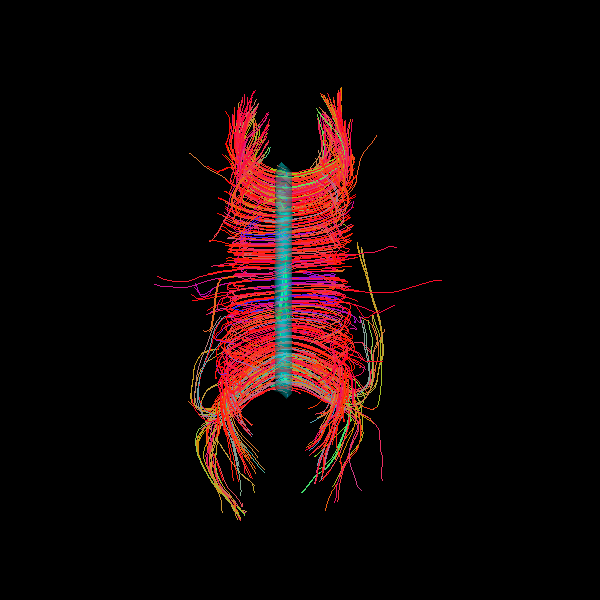 viz roi contour