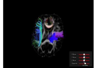 ../_images/sphx_glr_viz_advanced_thumb.png