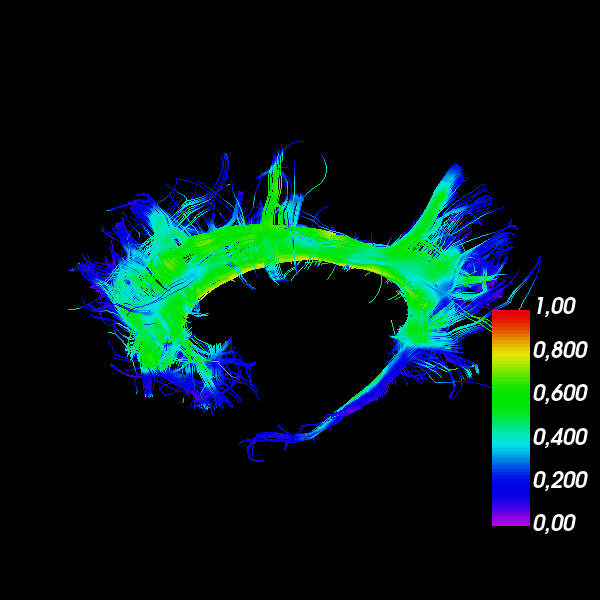 ../_images/sphx_glr_viz_bundles_002.png