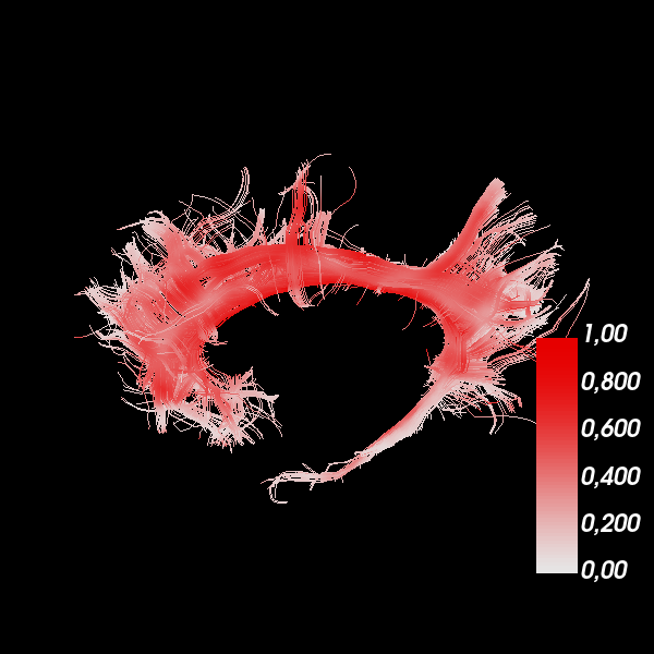 ../_images/sphx_glr_viz_bundles_003.png